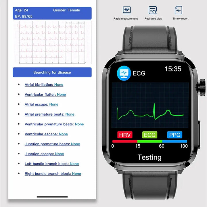 BioHealth Plus® - Relógio inteligente para monitoramento de glicose no sangue de lipídios, ácido úrico - ECG + PPG Fitness Tracker