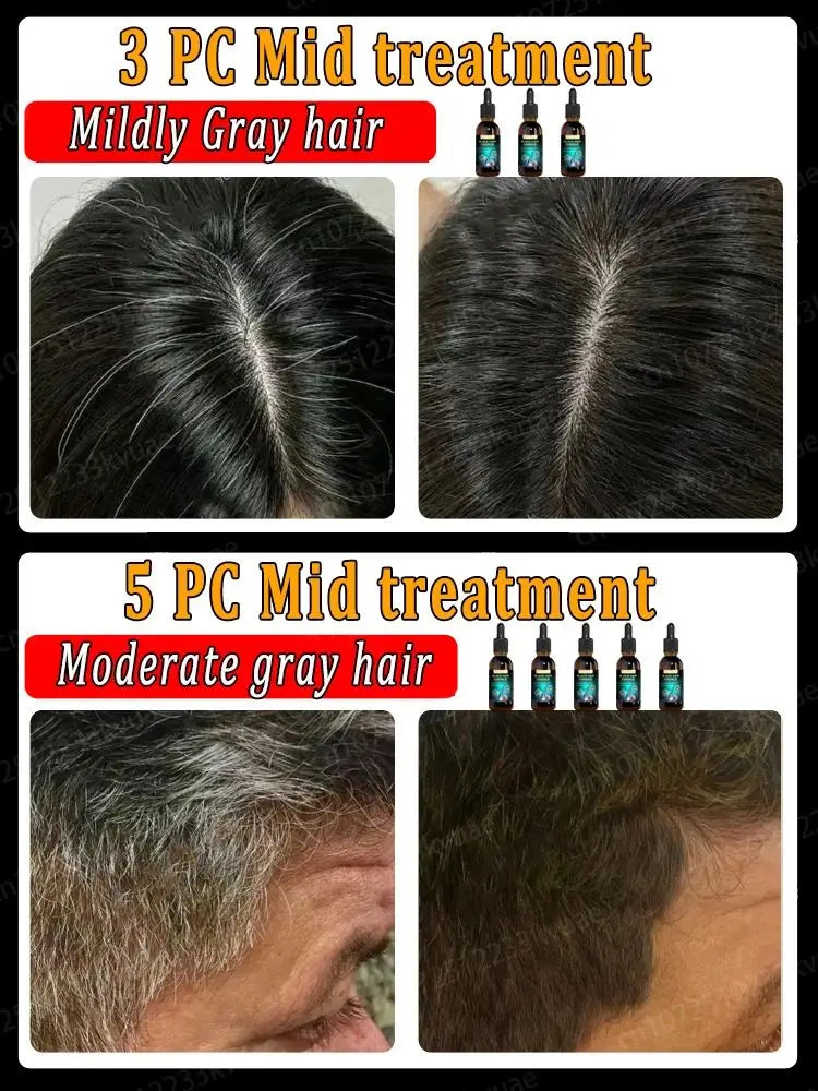 White hair treatment essence quickly turns white hair into black hair, repairs natural color, and prevents gray hair