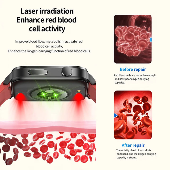 Açúcar no sangue não invasivo indolor - Smartwatch de tratamento a laser no Japão