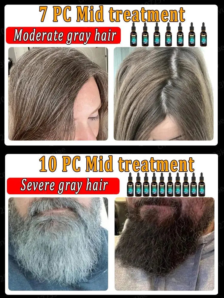 White hair treatment essence quickly turns white hair into black hair, repairs natural color, and prevents gray hair