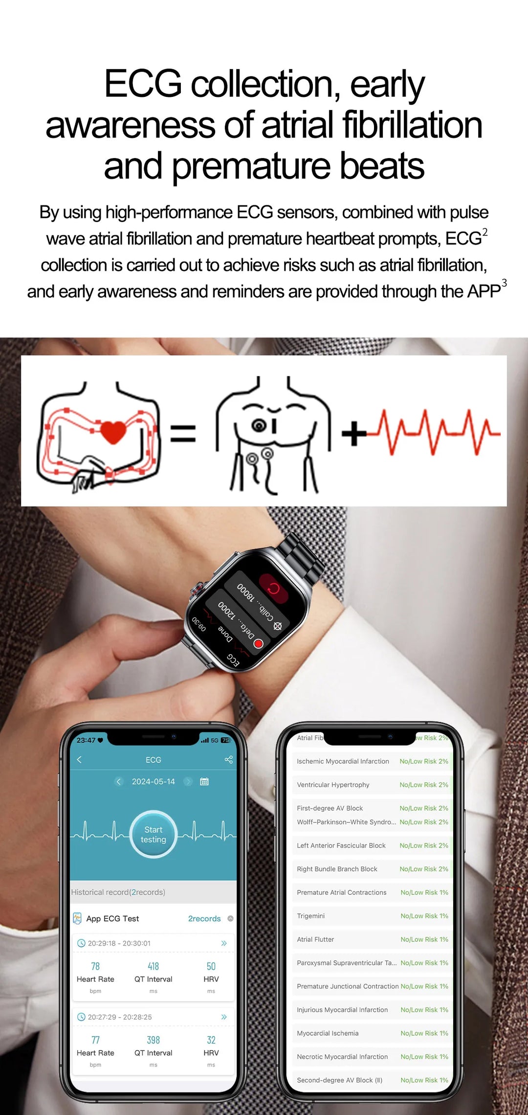 Lifesave Insight ® - Amoled Screen ECG Monitoring One Click Intelligent Micro Examination Bluetooth Call Smartwatch